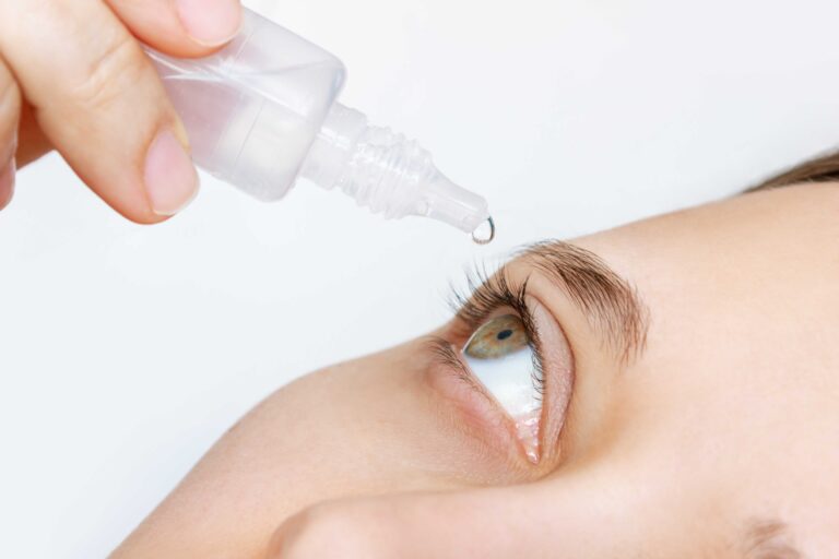 אישה מזליפה טיפות עיניים לעיניים יבשות